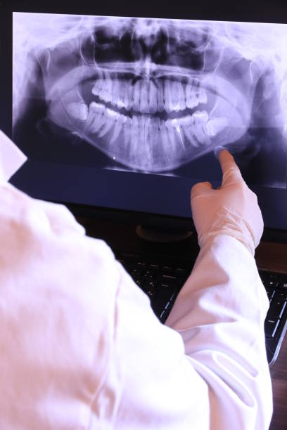 Best Broken or Chipped Tooth Repair in Gap, PA